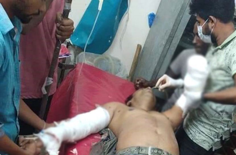 পটুয়াখালীতে শ্রমিক লীগ নেতার কব্জি কেটে দিলো সন্ত্রাসীরা
