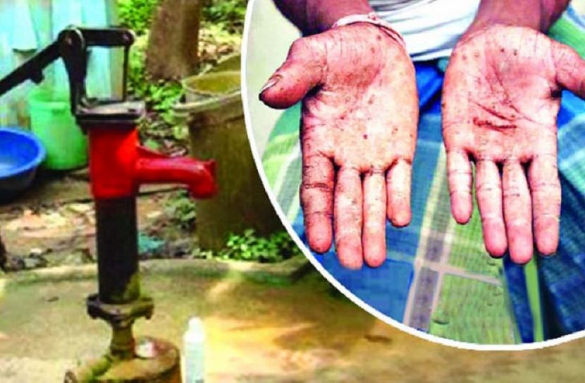 ‘আর্সেনিকযুক্ত পানির আঘাতে বিপর্যস্ত অর্থনীতি’