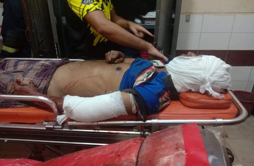 ব্রাহ্মণবাড়িয়ায় দুই ট্রাকের মুখোমুখি সংঘর্ষে আহত ৩