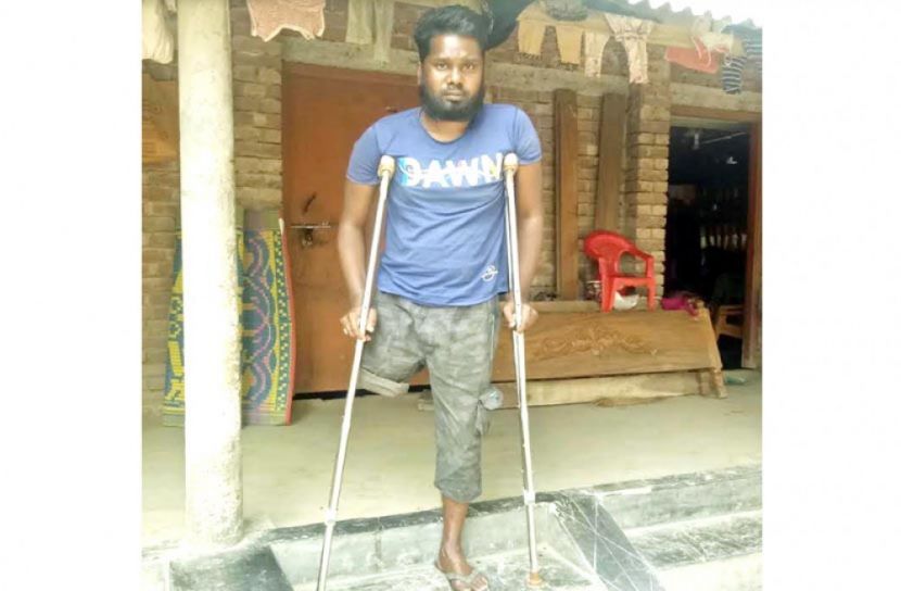 একটি পায়ের জন্য থমকে গেছে ফারুকের জীবন