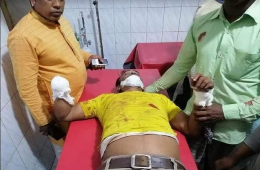 লালমোহনে স্বেচ্ছাসেবকলীগ নেতার কব্জি কর্তন