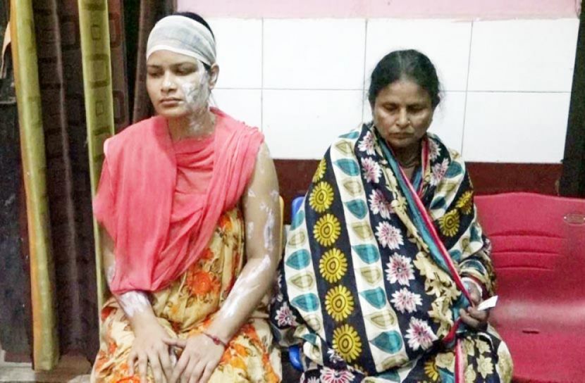 স্ত্রী ও শাশুড়িকে এসিড নিক্ষেপ