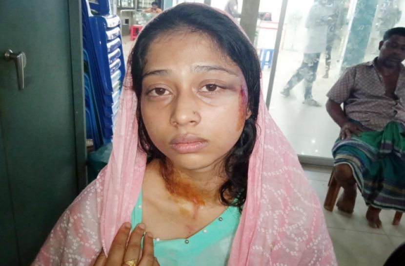 যৌতুকের জন্য গৃহবধূকে নির্যাতন করে হত্যার চেষ্টা
