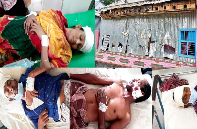 লুটপাটের ঘটনায় বাচ্চুসহ ৪৮ জনের বিরুদ্ধে মামলা 