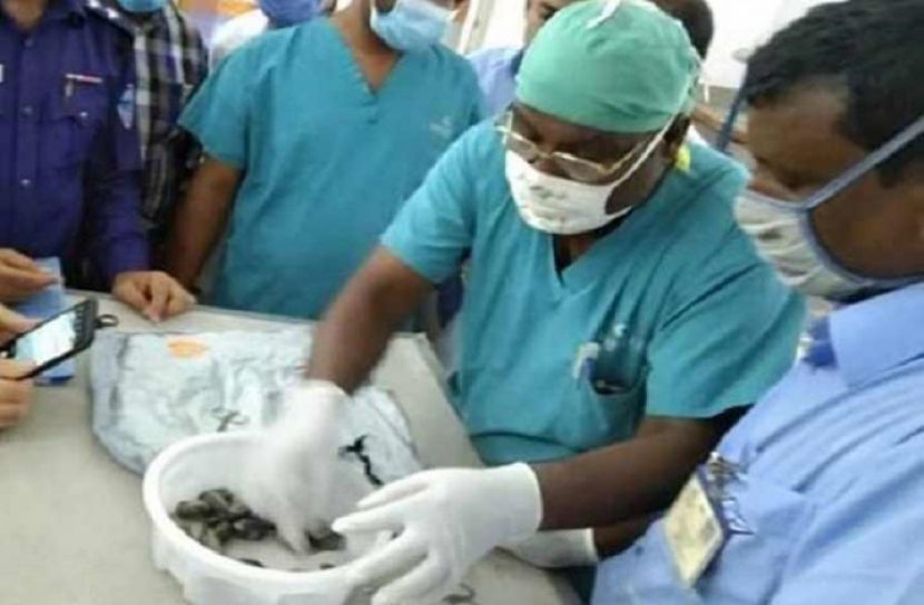 পেট ব্যথা, অপারেশনে মিলল ১৯৫০ পিস ইয়াবা