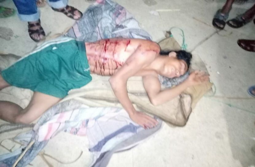ভাল্লুকের আক্রমণে চাষি আহত 