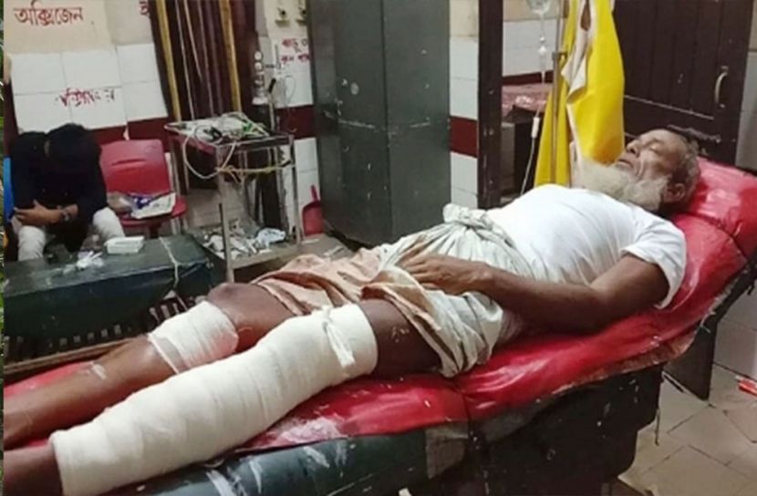 আখাউড়ায় বৃদ্ধকে বেধড়ক পিটিয়েছে প্রতিপক্ষরা