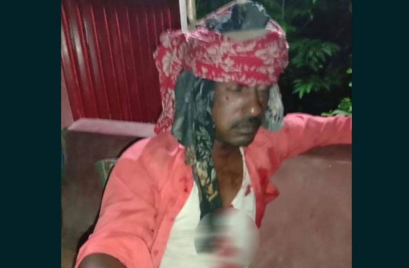 কোম্পানীগঞ্জে প্রতিপক্ষের গুলিতে আহত ৮
