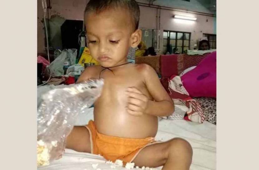 শিশুর পেটে শিশু, চমেক হাসপাতালে সফল অস্ত্রোপচার