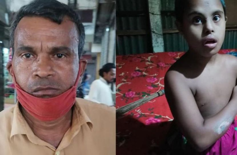 প্রধান শিক্ষক প্রতিবন্ধী শিশুর হাত ঝলসে দিলেন 