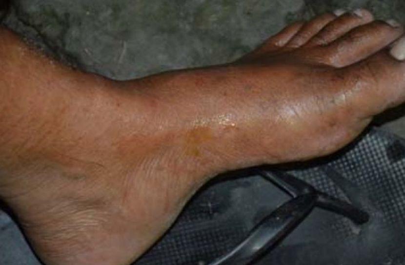 সাপের কামড়ে প্রাণ গেল নানি-নাতির