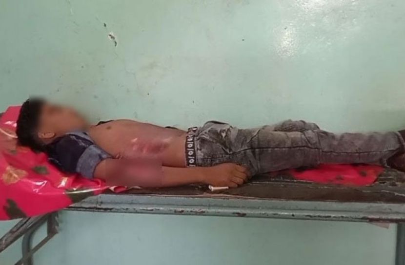 গাজীপুরে বাজি ফোটাতে গিয়ে কিশোর নিহত 