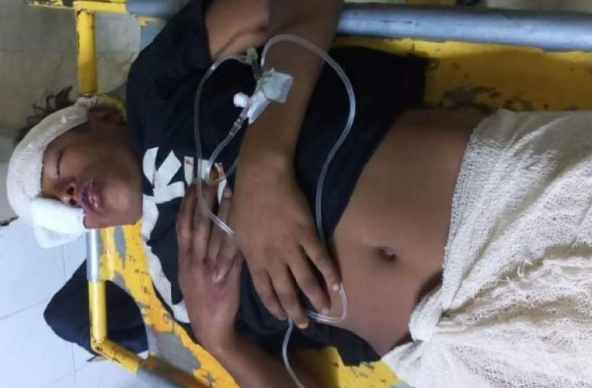 চলন্ত ট্রেনের ছাদ থেকে পড়ে আহত কিশোর 