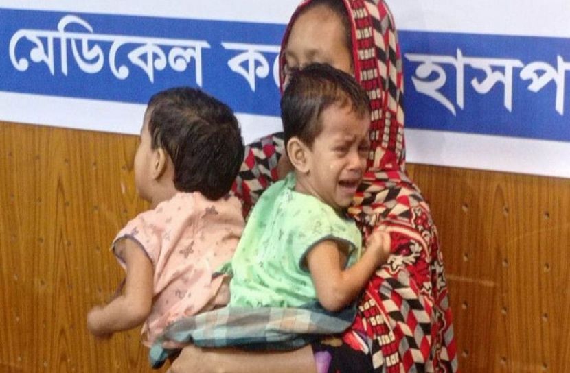 অস্ত্রোপচার কক্ষের বাহিরে দীর্ঘ সাড়ে চার ঘন্টা অপেক্ষায় থাকেন তাদের বাবা মা ও স্বজনরা