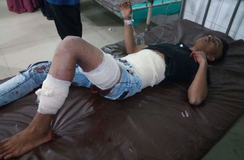 রাজধানীতে ছিনতাইকারীর ছুরিকাঘাতে কিশোর আহত