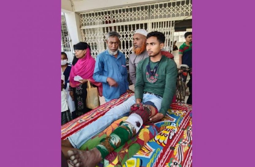 বোয়ালমারীতে ট্রলির ধাক্কায় মোটরসাইকেল চালকের ভেঙ্গে গেল পা