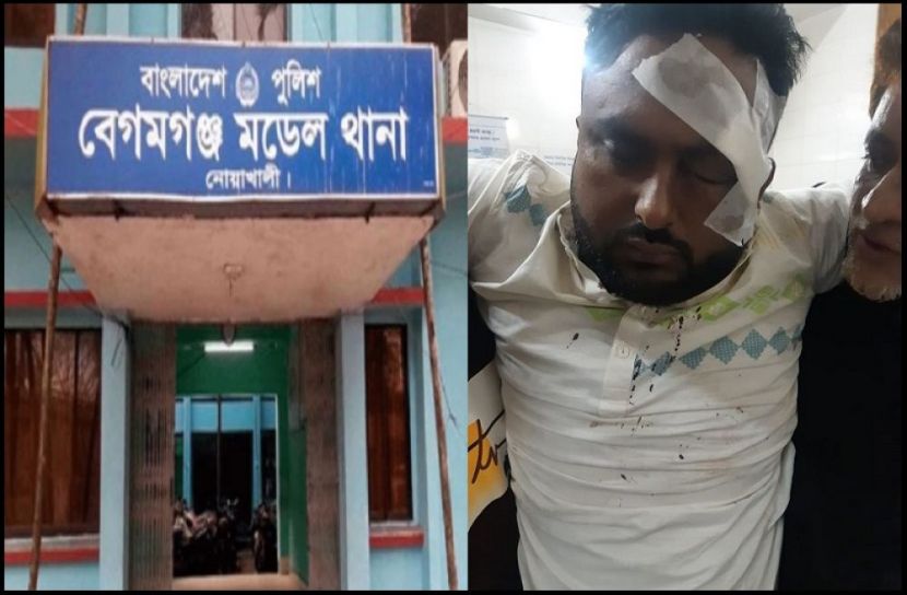 বেগমগঞ্জে চাঁদার দাবিতে কমিউনিটি সেন্টারে হামলা ,আহত ৩