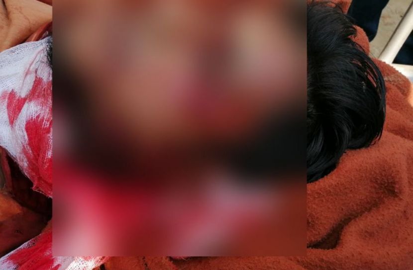 ঘুমন্ত স্বামীকে হত্যা করলেন রোহিঙ্গা স্ত্রী