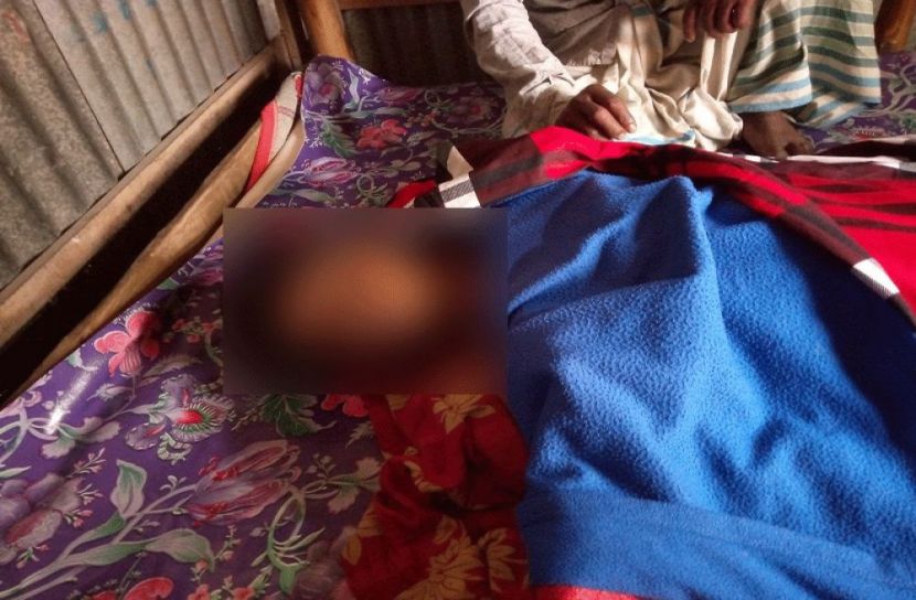 অষ্টগ্রামে গাছ থেকে পড়ে কিশোরের মৃত্যু
