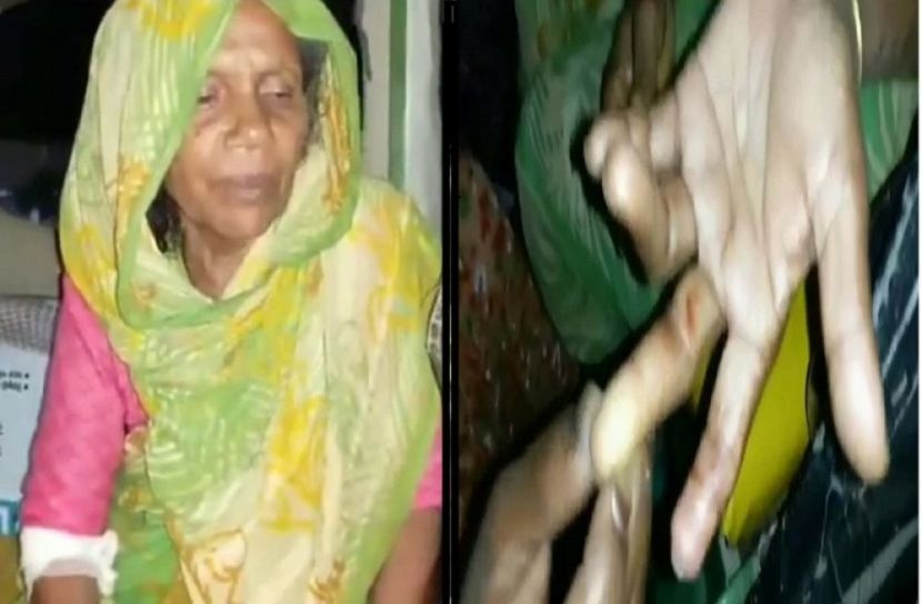 ছেলে-পুত্রবধূর বিরুদ্ধে মাকে মারধরের অভিযোগ