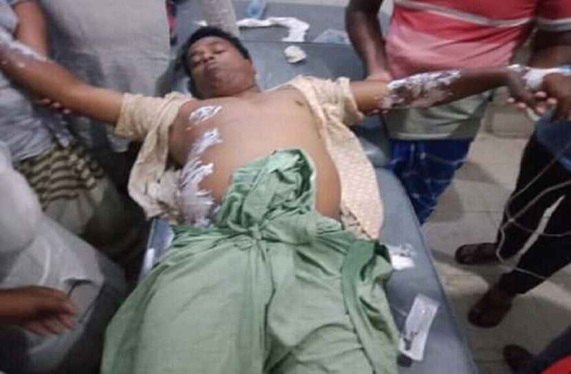 মনপুরায় প্রকৌশলী বিদ্যুৎ দূর্ঘটনায় আহত