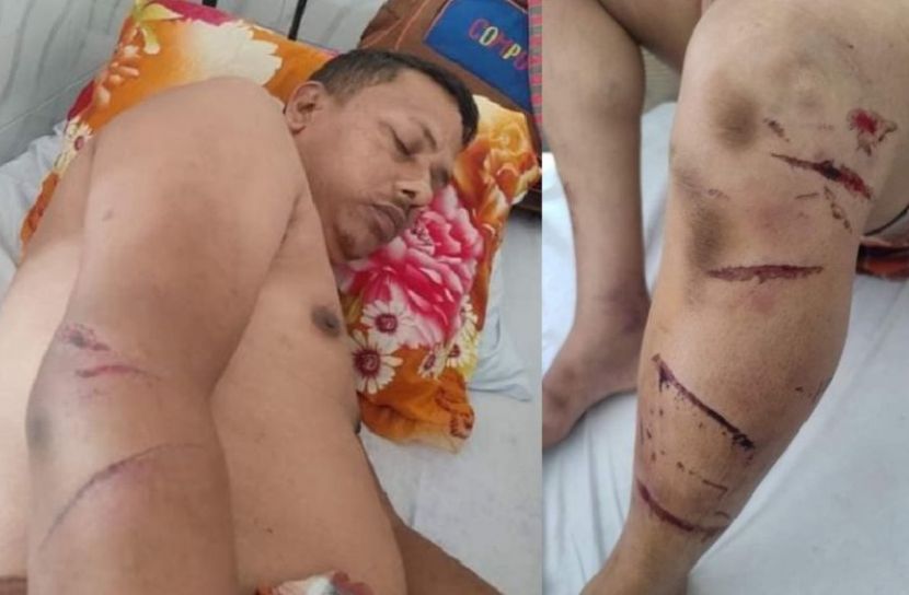 সন্ত্রাসী হামলায় ব্যবসায়ী আহত 