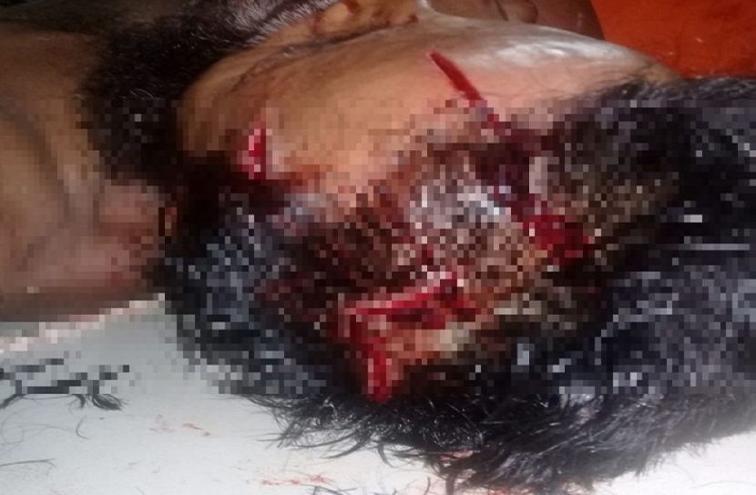 বড় ভাইকে কুপিয়ে জখম করল ছোট ভাই