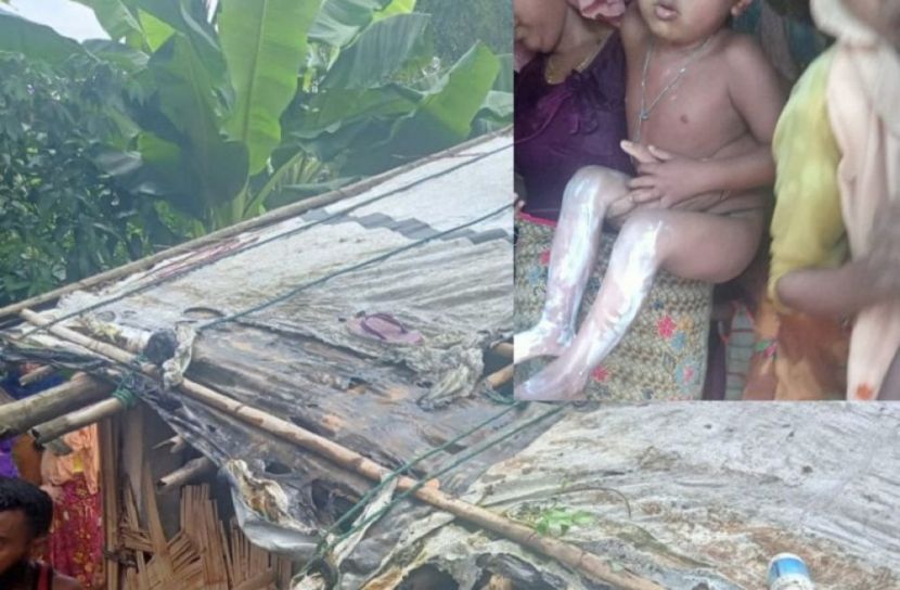 শিশুসহ তিন রোহিঙ্গা দগ্ধ