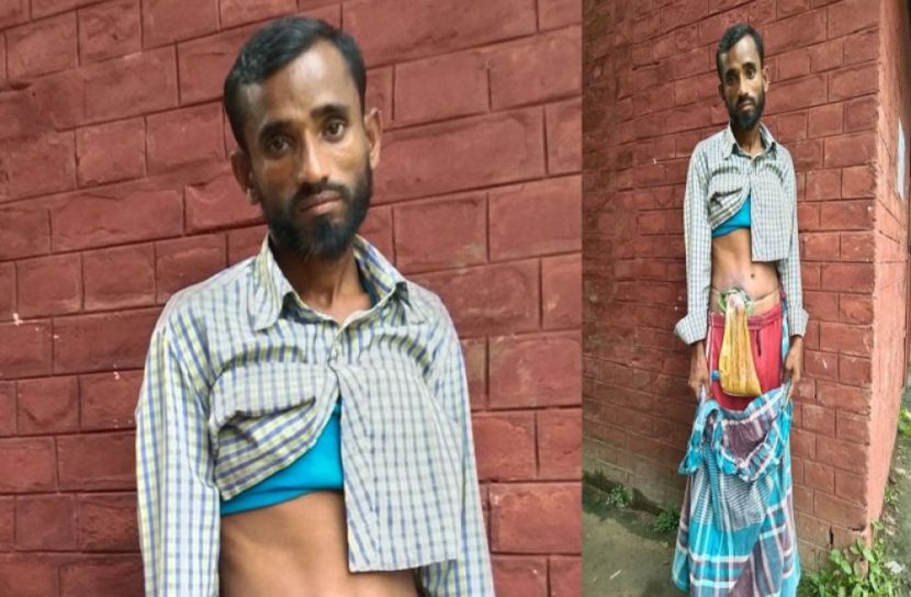 লিভার ছিদ্র, যা খান বেরিয়ে জমা হয় পলিথিনে