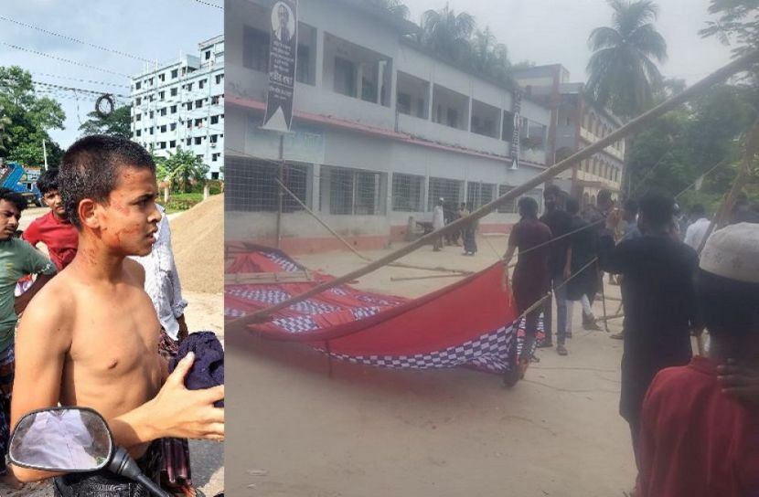 বিএনপির প্রতিবাদ সভা মঞ্চে হামলায় আহত ৩০