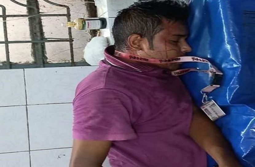 ছবি তোলার সময় হামলার শিকার সাংবাদিক