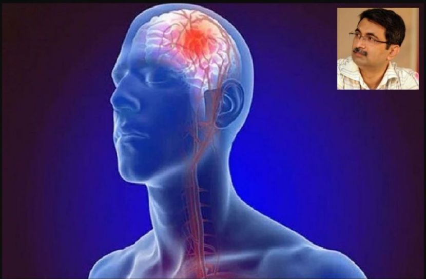স্ট্রোকের লক্ষণ জানুন, বাঁচিয়ে দিন বহু জীবন