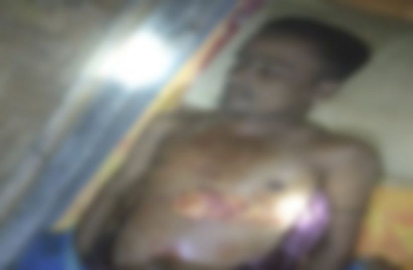 উখিয়ায় ঘরে ঢুকে রোহিঙ্গা মাঝিকে হত্যা