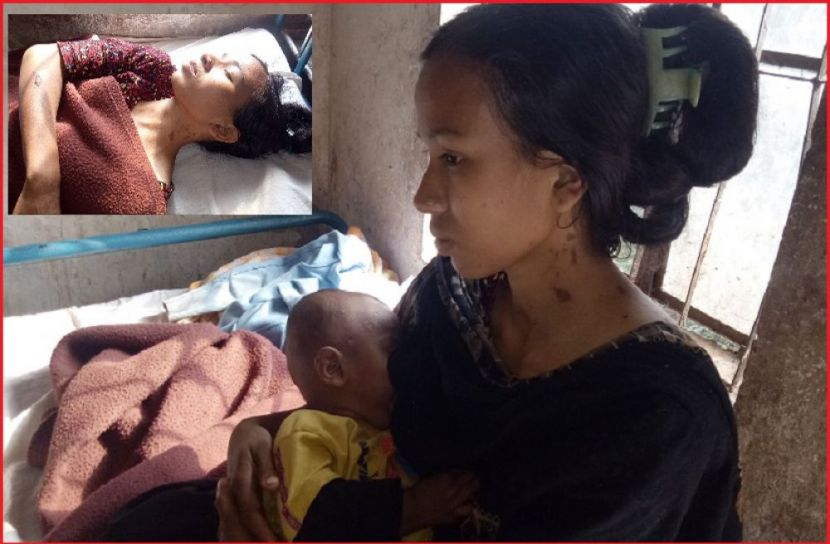 স্ত্রীর শরীরে গরম ডাল ছুড়ে দিল পাষণ্ড স্বামী।