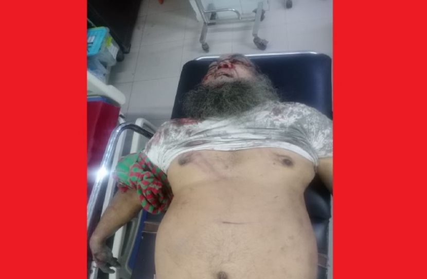 টেকনাফে ভাইয়ের হাতে ভাই খুন!