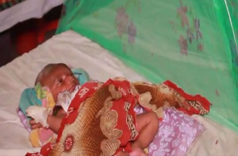 ক্যানোলা খুলতে গিয়ে আঙ্গুল কেটে ফেলার অভিযোগ