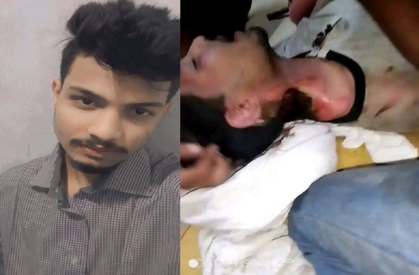 পল্লী বিদ্যুৎ সমিতির অব্যবস্থাপনায় গাছে অগ্নিদগ্ধ শ্রমিক