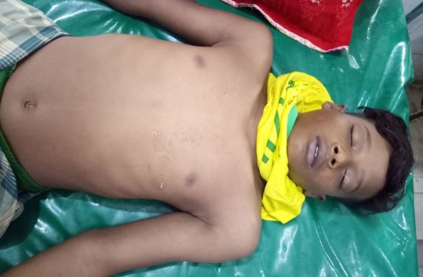 উলিপুরে ডায়রিয়ায় এক শিশুর মৃত্যু