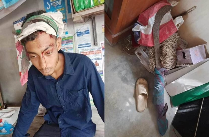 বোয়ালমারীতে শিক্ষার্থীকে কুপিয়ে জখম