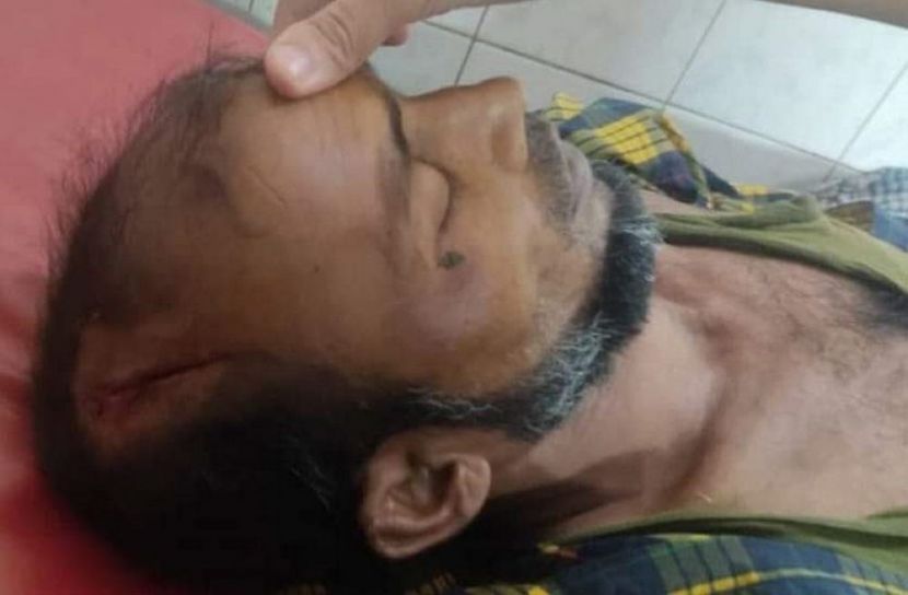 ভাতিজার লাঠির আঘাতে চাচার মৃত্যু
