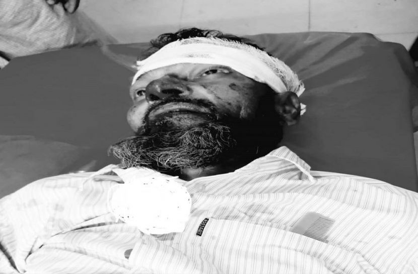 সিএনজি উল্টে বৃদ্ধের মৃত্যু