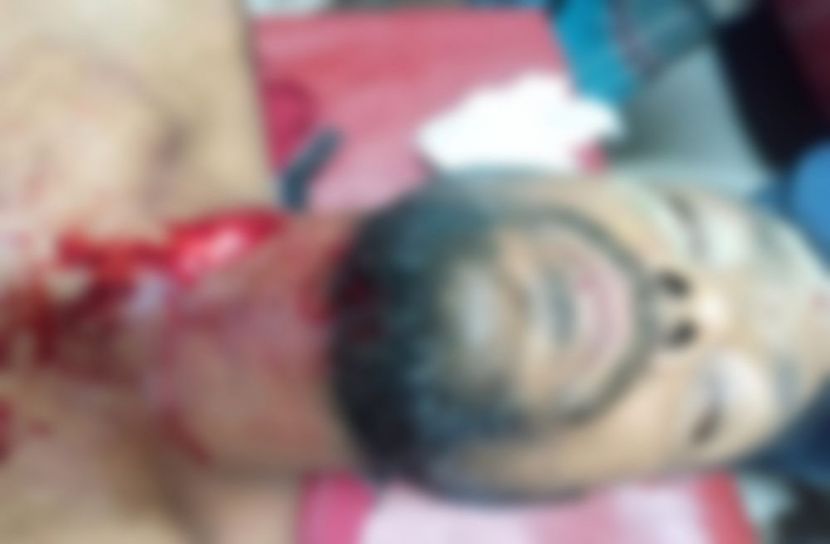 চালকের গলা কেটে অটোরিকশা ছিনতাই