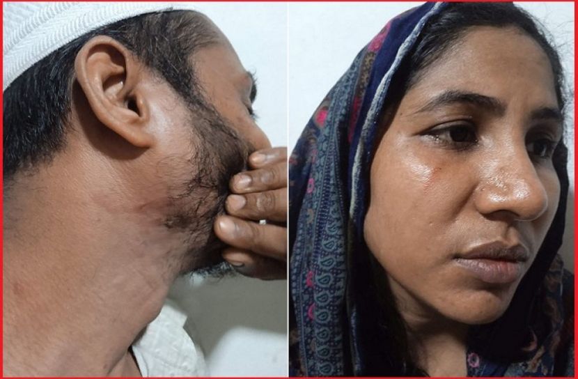 ছবি : সংগৃহিত