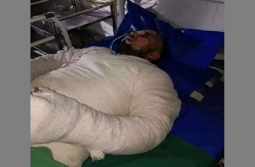 পেট্রোলের আগুনে হোটেল ম্যানেজারের মৃত্যু
