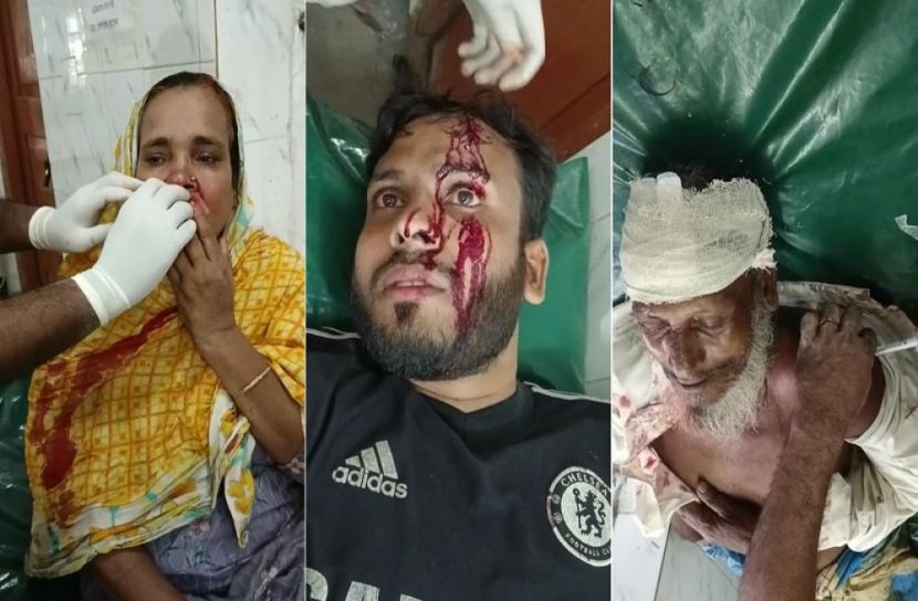 একই পরিবারের ৫ জনকে কুপিয়ে জখম
