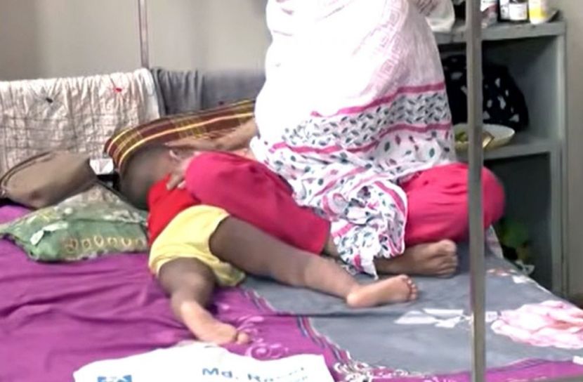 দেশজুড়ে হাম আতঙ্ক: তিন মাসে ৬৬৬ শিশুর মৃত্যু
